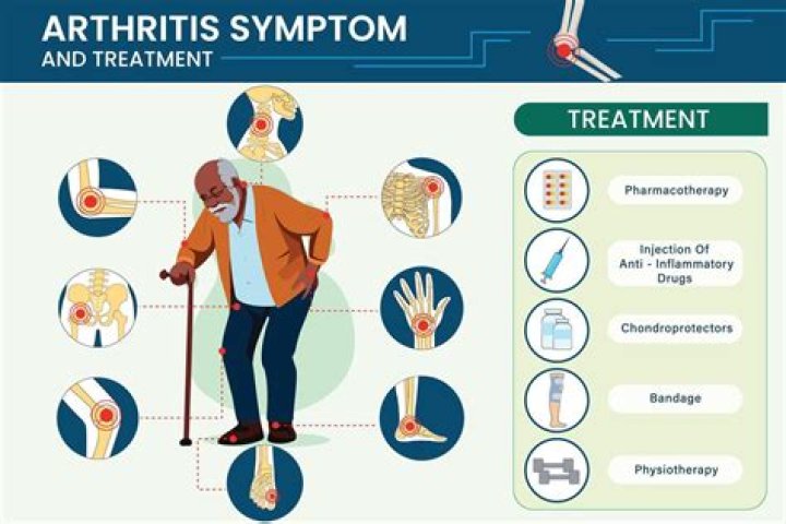 Does having arthritis hurt all the time?