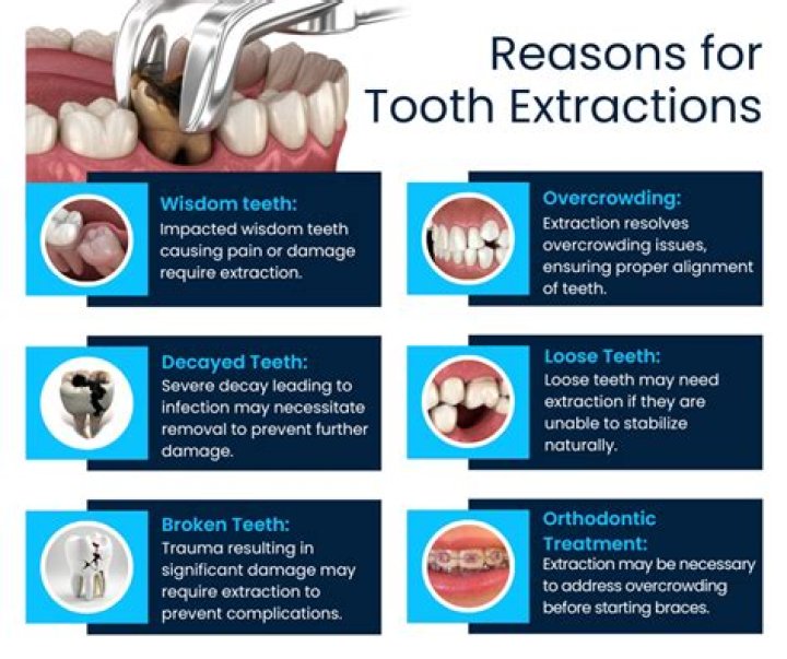 Is it painful to remove tooth?