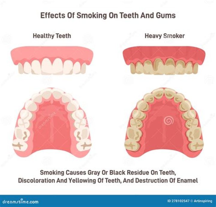 What does a smoker's mouth look like?