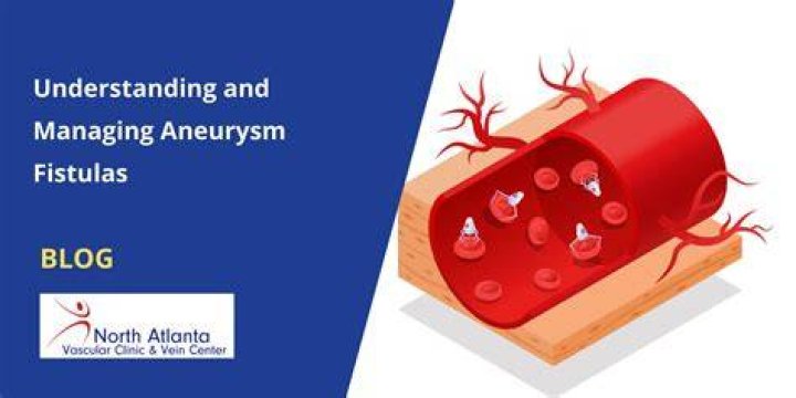 What is fistula aneurysm?